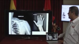 Alcalde de Tarija continuará trabajando pese a las lesiones que sufrió tras su accidente